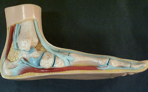 flatfoot